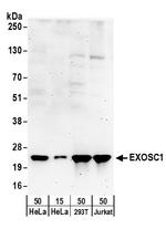 EXOSC1 Polyclonal Antibody