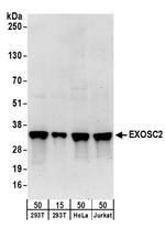 EXOSC2 Polyclonal Antibody