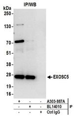 EXOSC5 Antibody in Immunoprecipitation (IP)