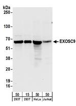 EXOSC9 Polyclonal Antibody