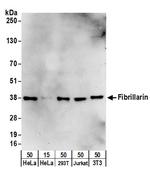 Fibrillarin Polyclonal Antibody