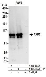 FXR2 Antibody in Immunoprecipitation (IP)