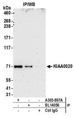 KIAA0020 Antibody in Immunoprecipitation (IP)