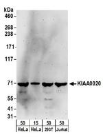 KIAA0020 Polyclonal Antibody