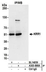 KRR1 Antibody in Immunoprecipitation (IP)