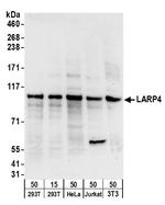 LARP4 Polyclonal Antibody