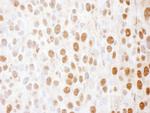 SS-B Antibody in Immunohistochemistry (Paraffin) (IHC (P))