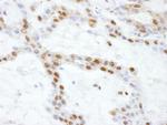 SS-B Antibody in Immunohistochemistry (Paraffin) (IHC (P))