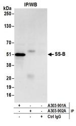 SS-B Antibody in Immunoprecipitation (IP)