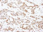 SS-B Antibody in Immunohistochemistry (Paraffin) (IHC (P))