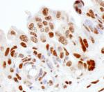 SS-B Antibody in Immunohistochemistry (Paraffin) (IHC (P))