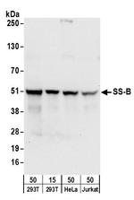 SS-B Antibody in Western Blot (WB)