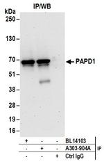 PAPD1 Antibody in Immunoprecipitation (IP)