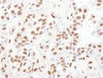 53BP1 Antibody in Immunohistochemistry (Paraffin) (IHC (P))