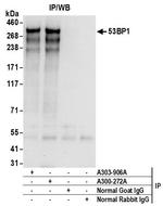 53BP1 Antibody in Immunoprecipitation (IP)