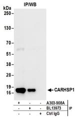 CARHSP1 Antibody in Immunoprecipitation (IP)