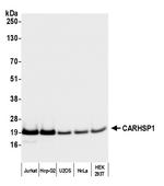 CARHSP1 Polyclonal Antibody