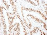 hnRNP M3/4 Antibody in Immunohistochemistry (Paraffin) (IHC (P))