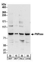 PNPase Polyclonal Antibody