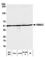 RBM22 Polyclonal Antibody