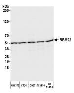 RBM22 Antibody in Western Blot (WB)