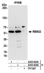 RBM22 Antibody in Immunoprecipitation (IP)