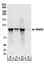 RBM28 Polyclonal Antibody