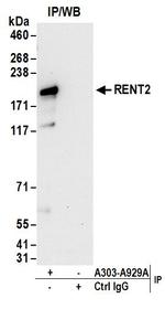 RENT2 Antibody in Immunoprecipitation (IP)