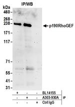 p190RhoGEF Antibody in Immunoprecipitation (IP)