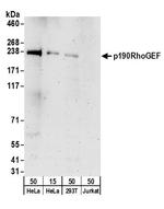 p190RhoGEF Polyclonal Antibody