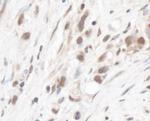 RPL5 Polyclonal Antibody