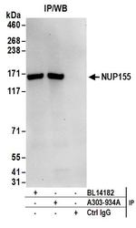 NUP155 Antibody in Immunoprecipitation (IP)