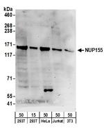 NUP155 Polyclonal Antibody