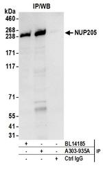 NUP205 Antibody in Immunoprecipitation (IP)