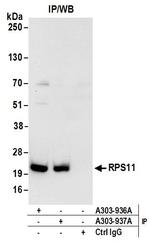 RPS11 Antibody in Immunoprecipitation (IP)