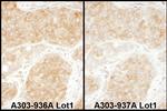 RPS11 Polyclonal Antibody
