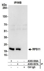 RPS11 Antibody in Immunoprecipitation (IP)