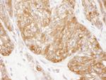 SERBP1 Polyclonal Antibody
