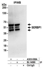 SERBP1 Antibody in Immunoprecipitation (IP)