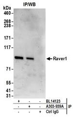 Raver1 Antibody in Immunoprecipitation (IP)