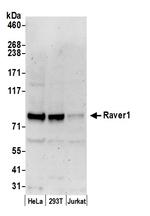 Raver1 Antibody in Western Blot (WB)