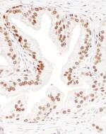 DBC1/p30 DBC Polyclonal Antibody