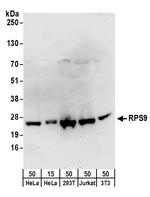 RPS9 Antibody in Western Blot (WB)