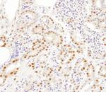 SNRPA1 Antibody in Immunohistochemistry (Paraffin) (IHC (P))