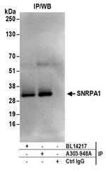 SNRPA1 Antibody in Immunoprecipitation (IP)