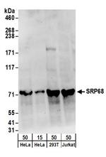SRP68 Polyclonal Antibody