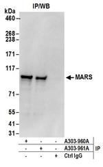 MARS Antibody in Immunoprecipitation (IP)