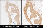 MARS Polyclonal Antibody