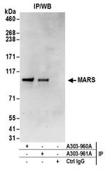 MARS Antibody in Immunoprecipitation (IP)