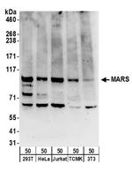 MARS Antibody in Western Blot (WB)